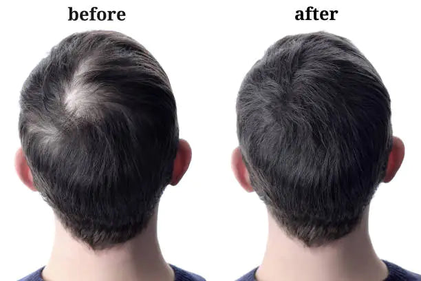 PURC Grows Hair Oil